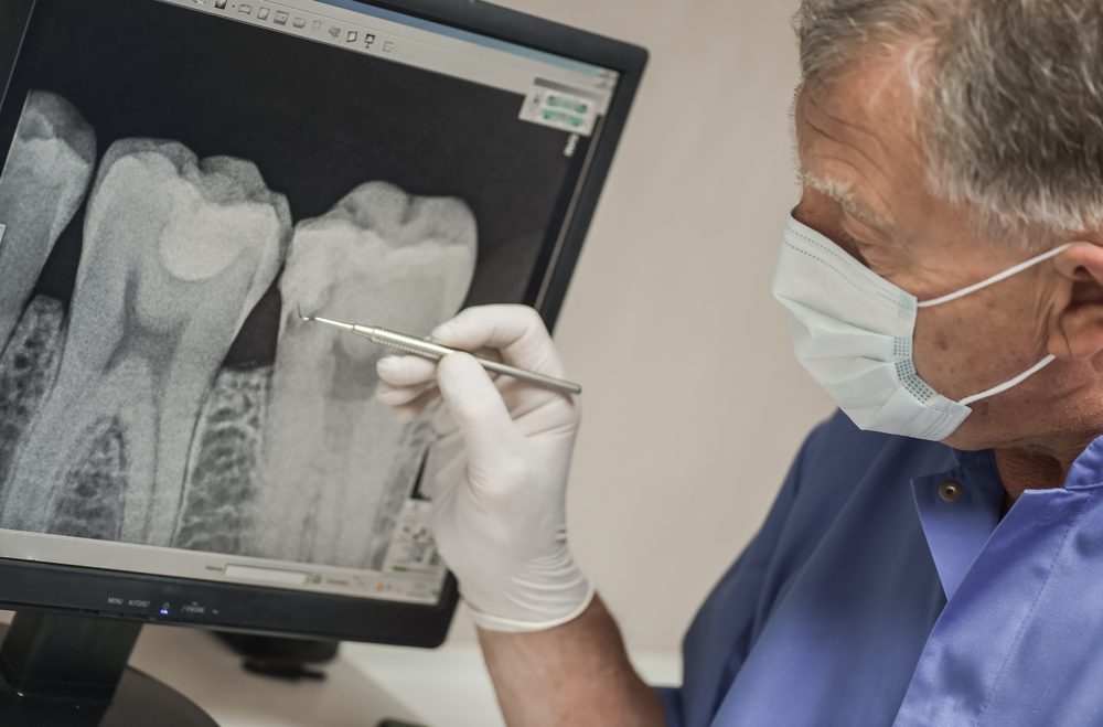 Male dentist viewing x-ray on computer screen.